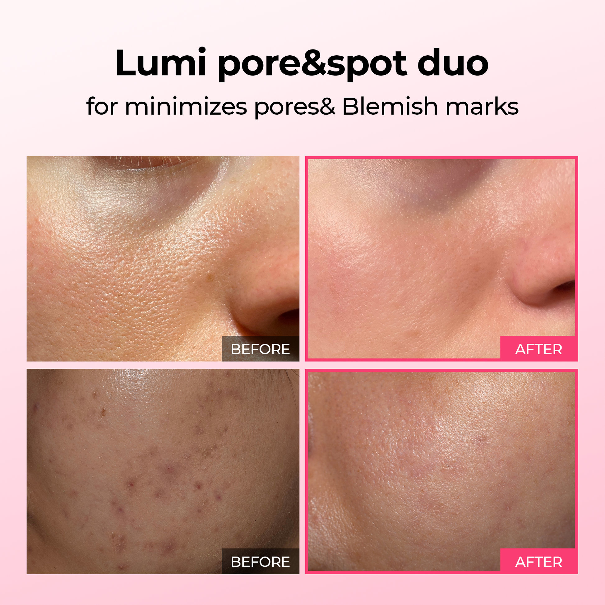 [TikTok Bestseller] Lumi Firm & Lift Duo Set 2-Pack Bundle